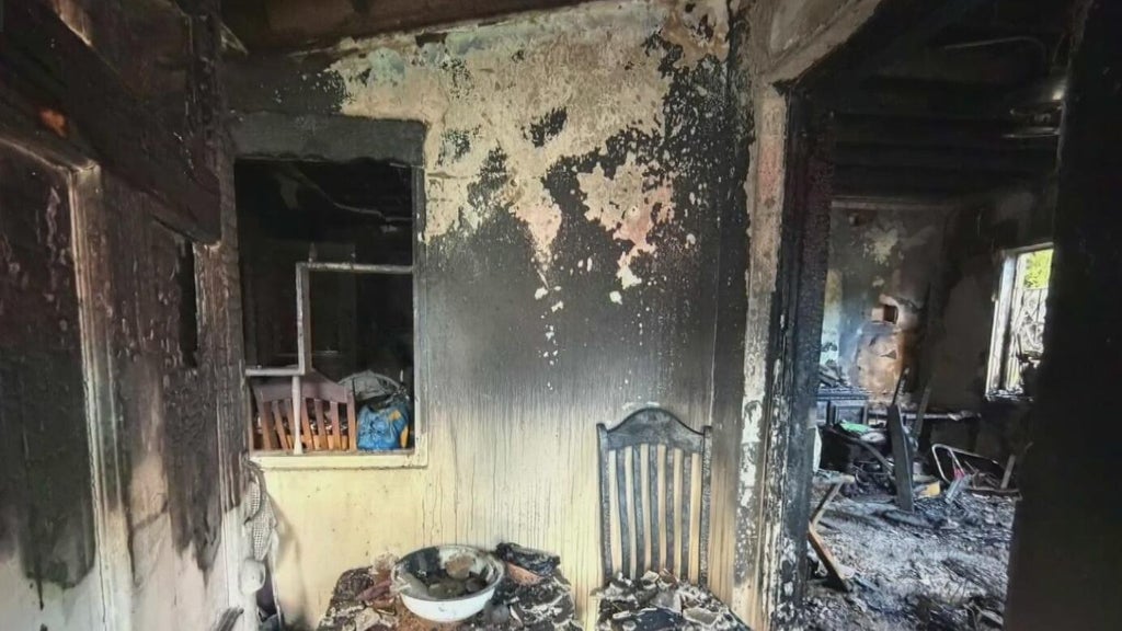 Woman hospitalized after Miami house fire leaves three displaced — CBS Miami, Garland Health news